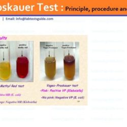 Methyl red and voges-proskauer tests