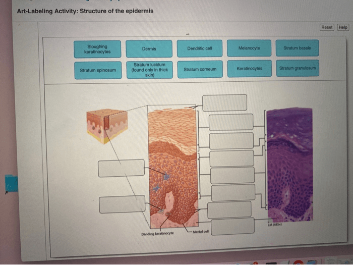 Art-labeling activity the structure of the epidermis